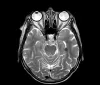 Scoperta cerebrale rivoluziona la conoscenza delle abitudini