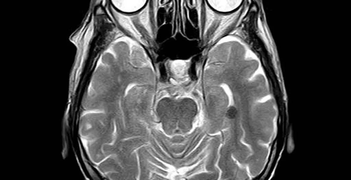Scoperta cerebrale rivoluziona la conoscenza delle abitudini
