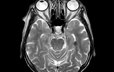 Scoperta cerebrale rivoluziona la conoscenza delle abitudini