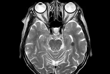 Scoperta cerebrale rivoluziona la conoscenza delle abitudini
